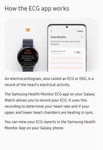 how ecg works