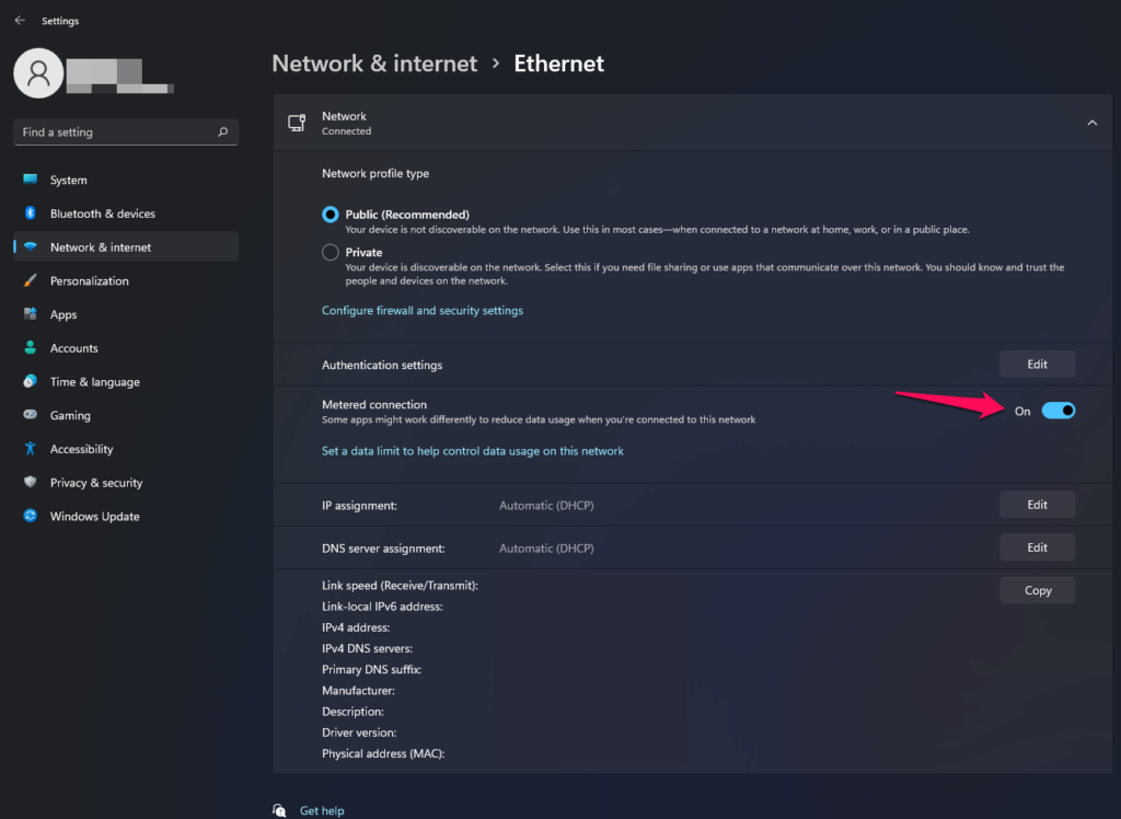 Disable Metered Connection in LAN Network (4)
